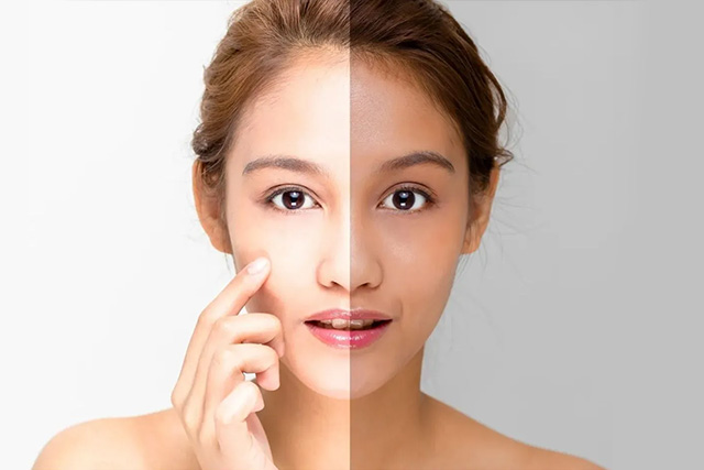 Brightening Treatment